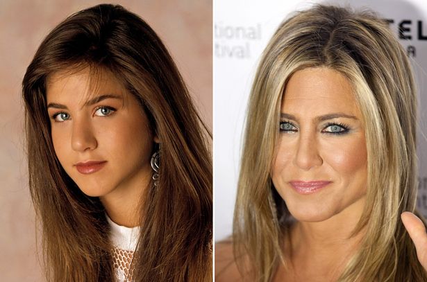 Jennifer-Aniston-before-and-after-nose-surgery