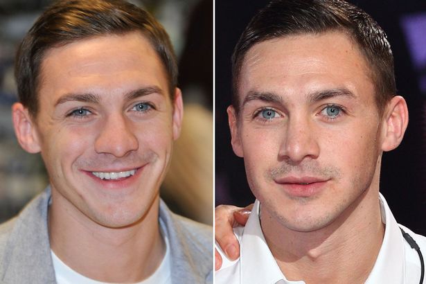 Kirk-Norcross-nose-job