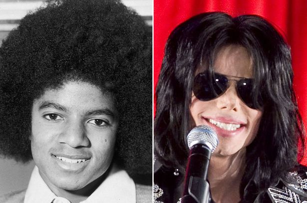Michael-Jackson-before-and-after-nose-surgery