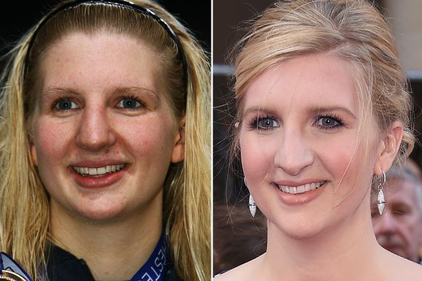 Rebecca-Adlington-nose-job